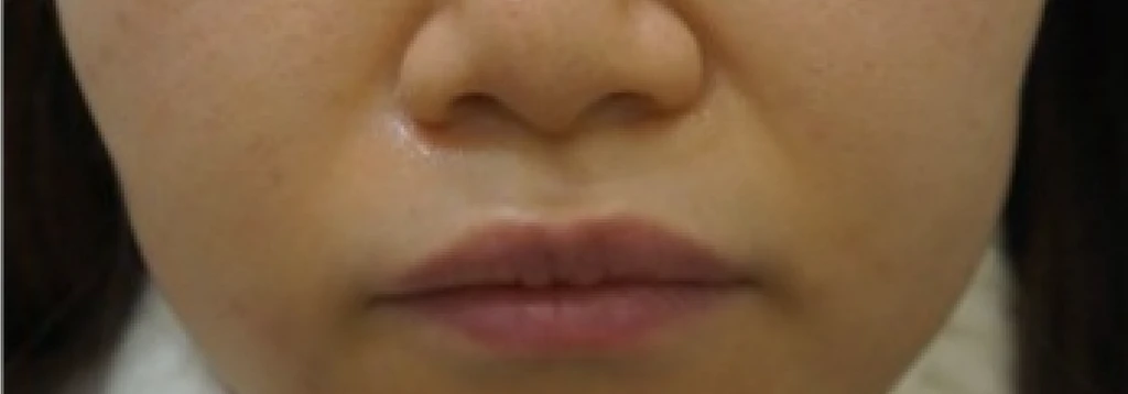 before_image