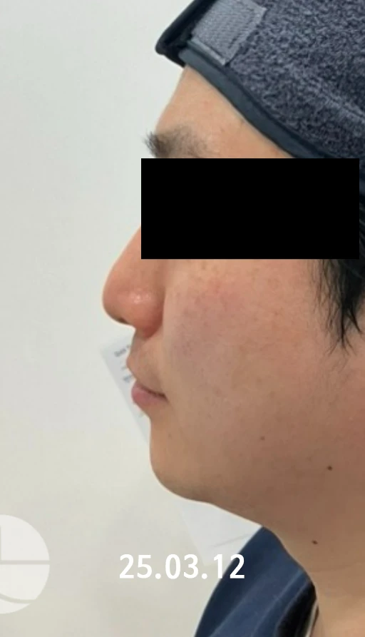 before_image
