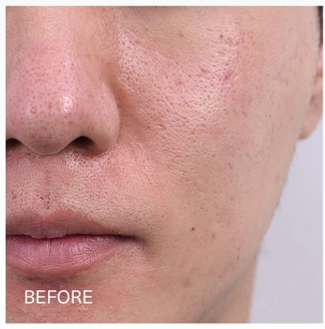 before_image