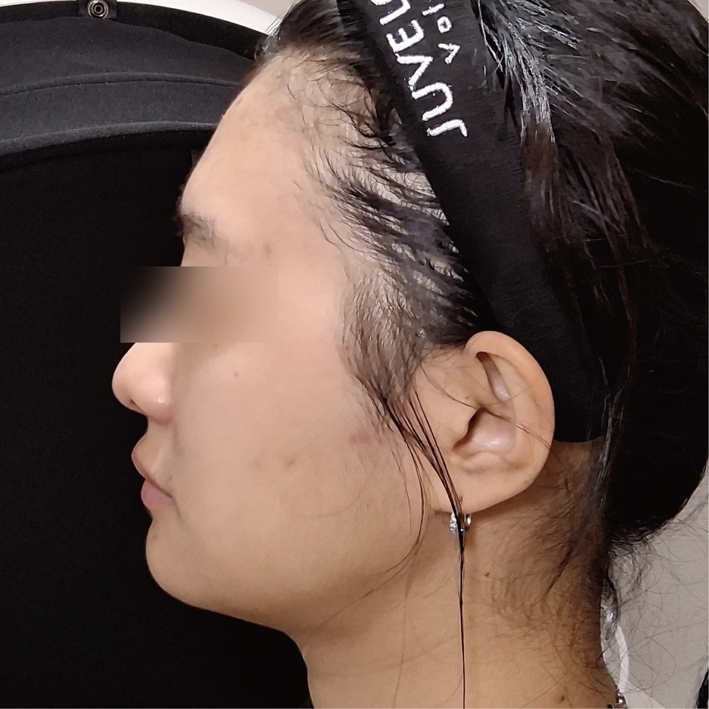 before_image