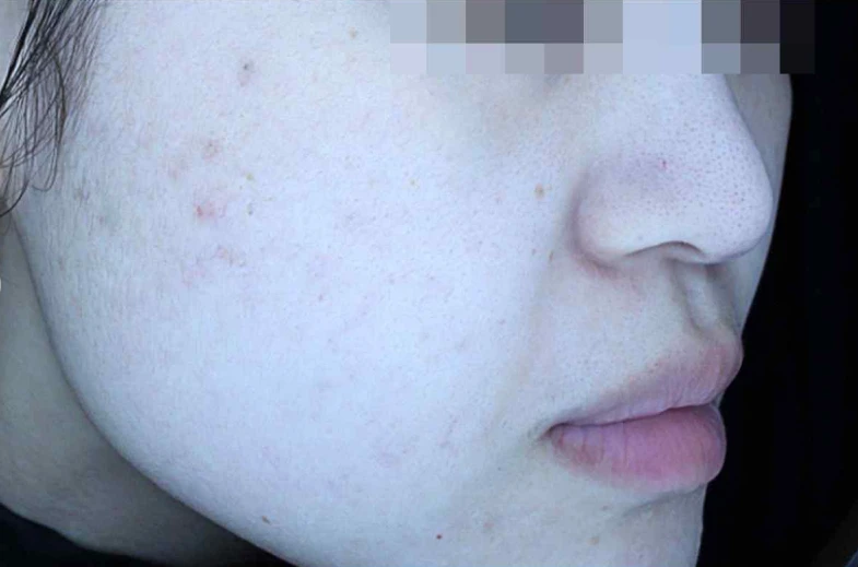 before_image