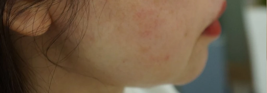 before_image