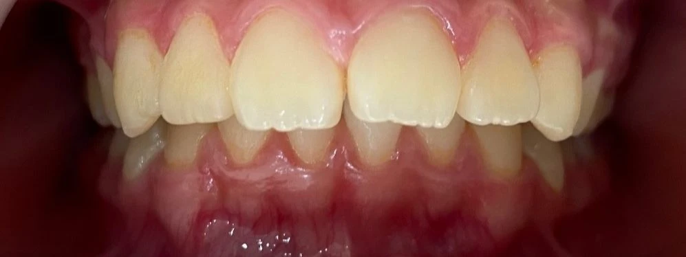 before_image