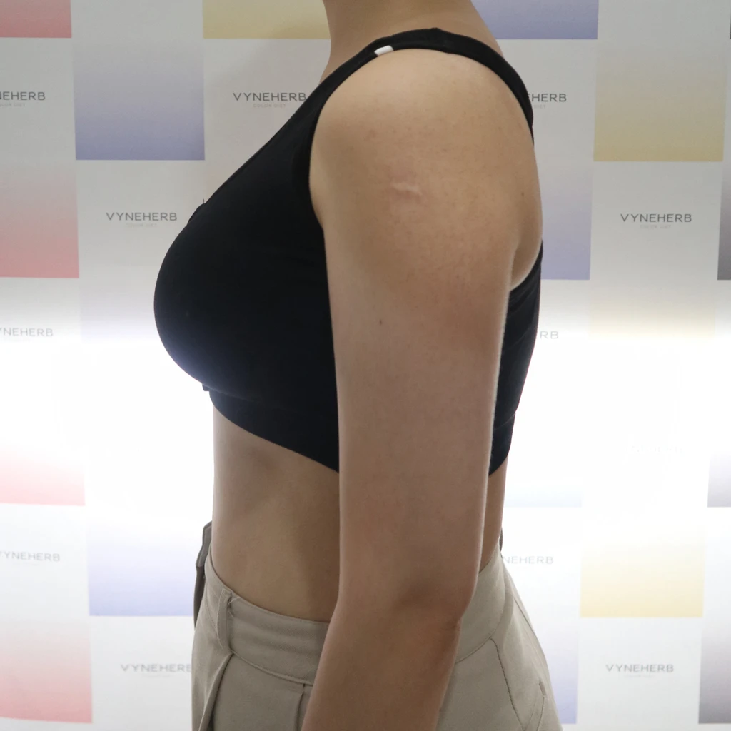 before_image