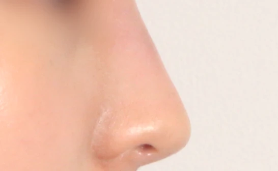 before_image