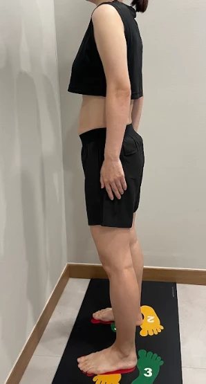 before_image