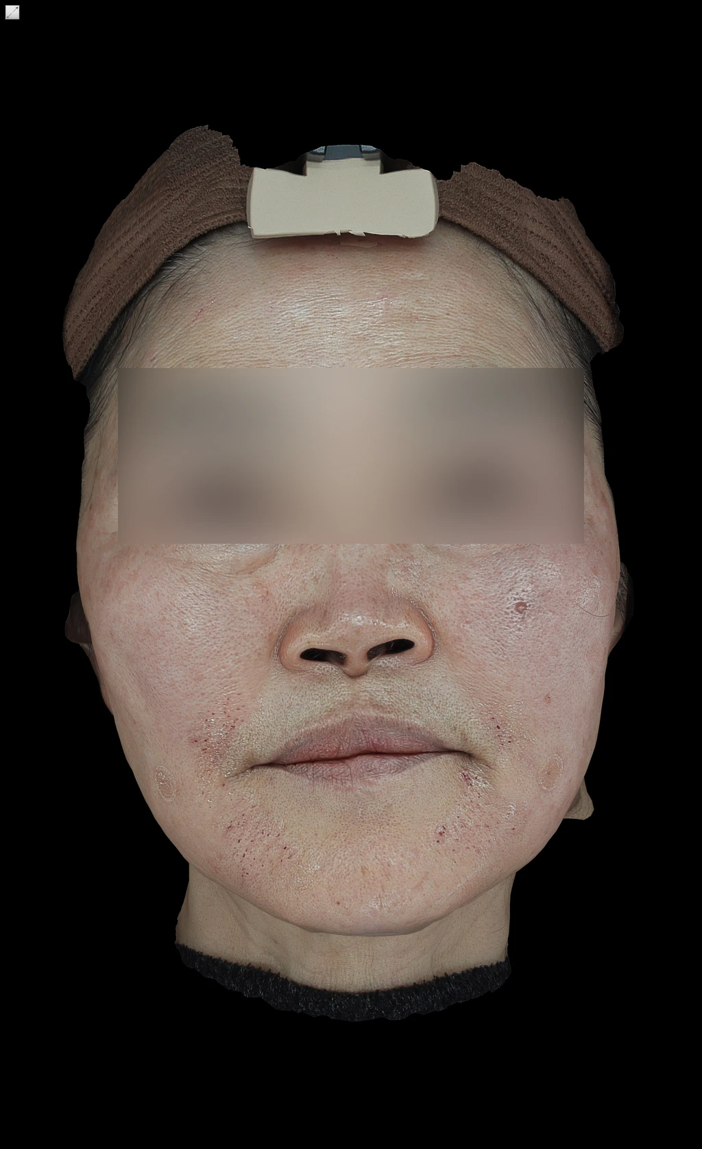 before_image