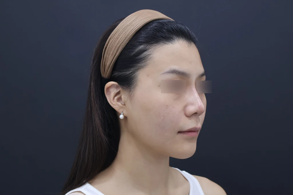 before_image