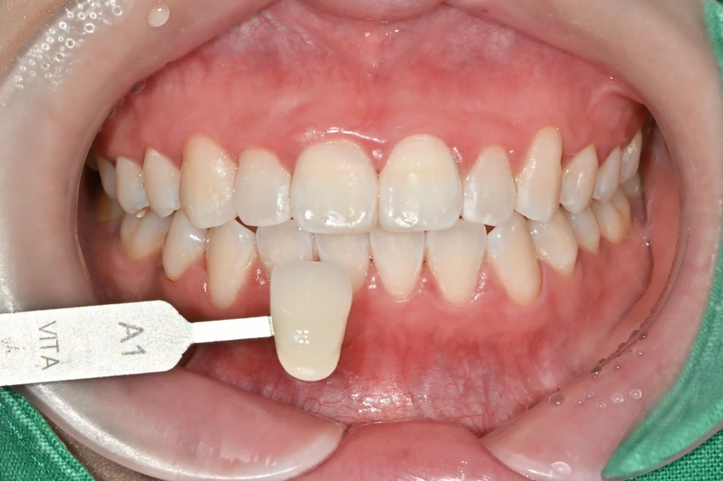 before_image