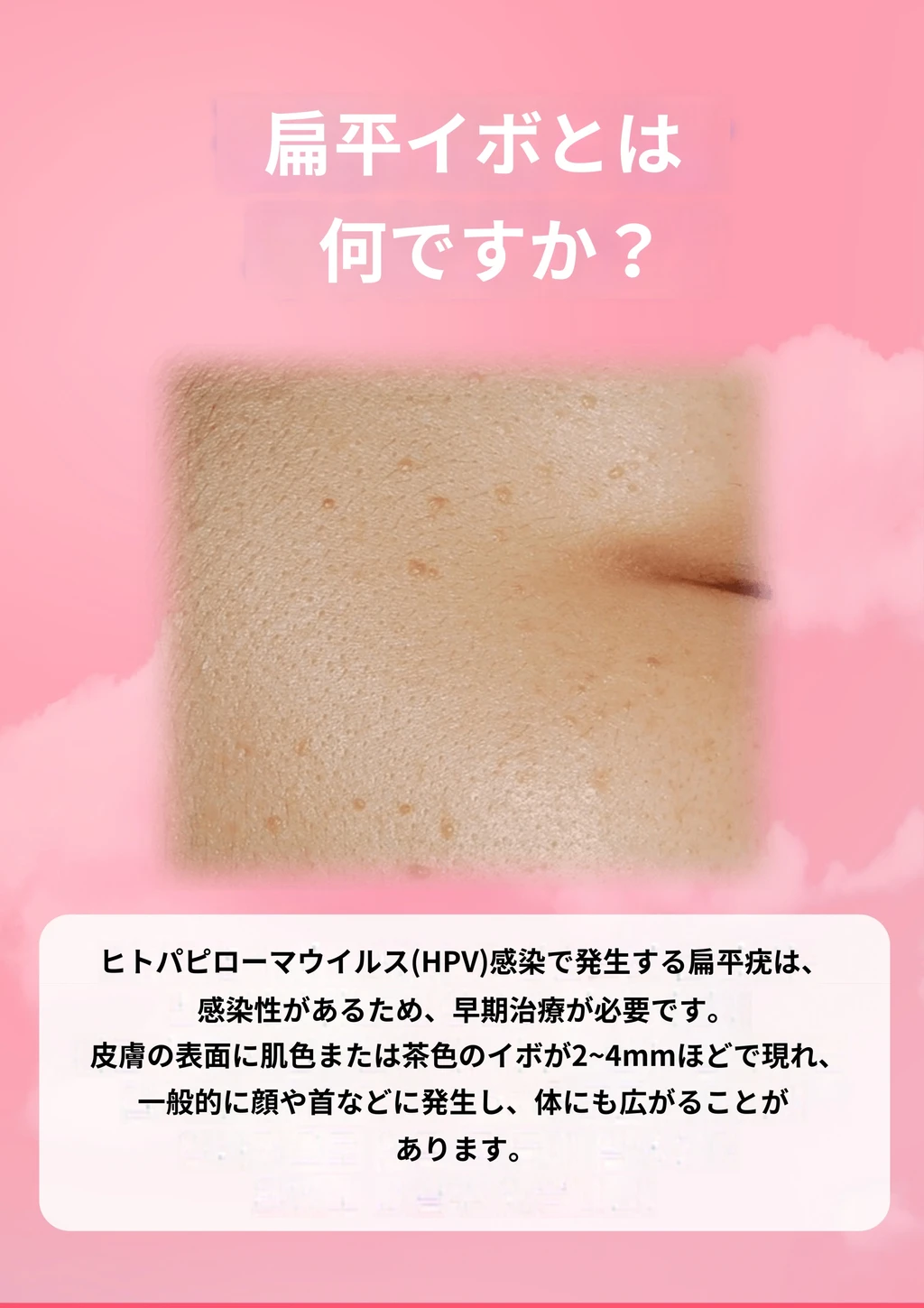 treatmentIntroduction