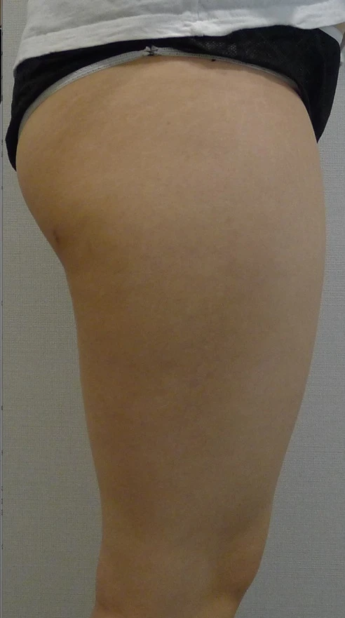 before_image