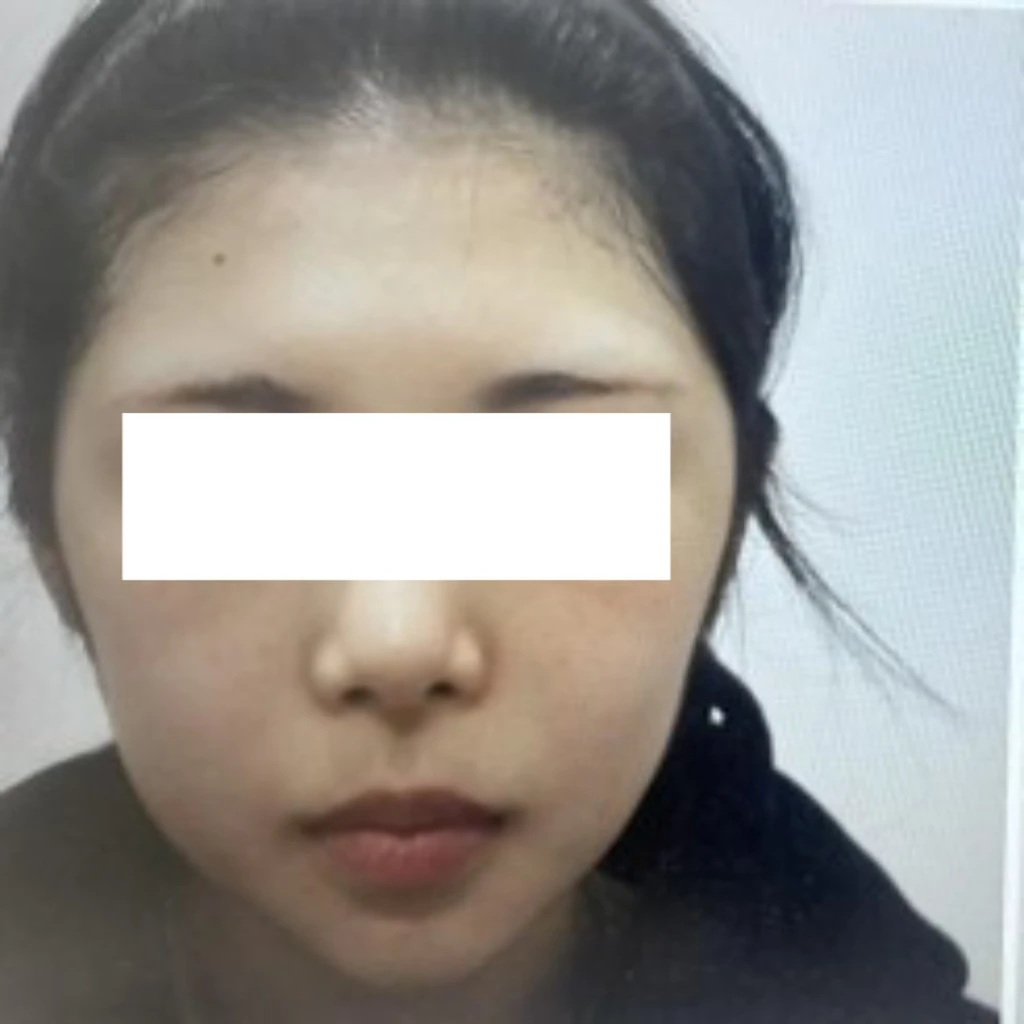 before_image