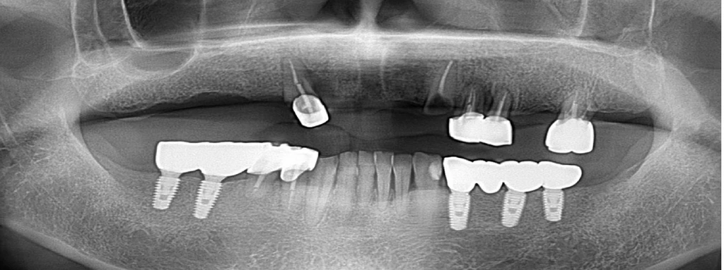 before_image