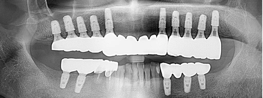 before_image