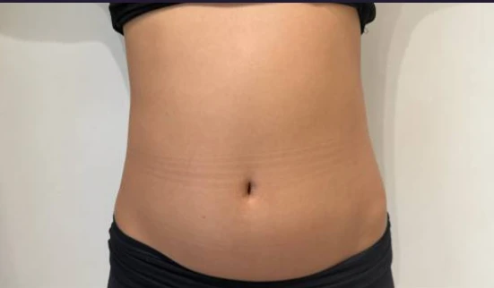 before_image