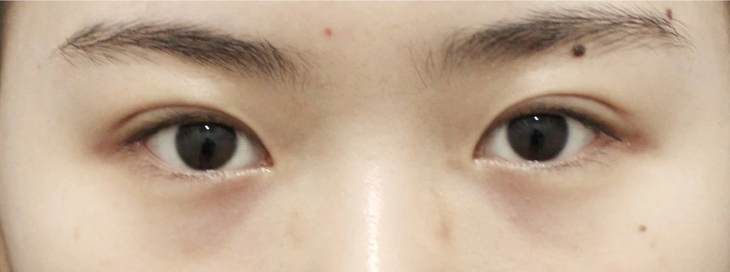 before_image