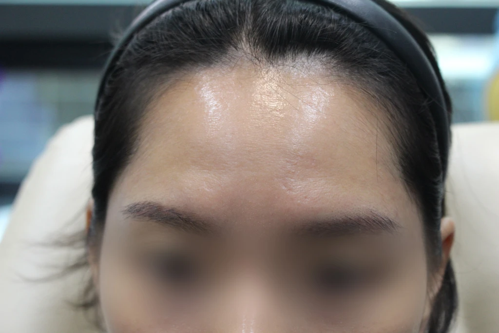 before_image