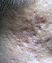 before_image