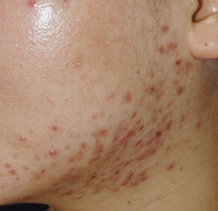before_image
