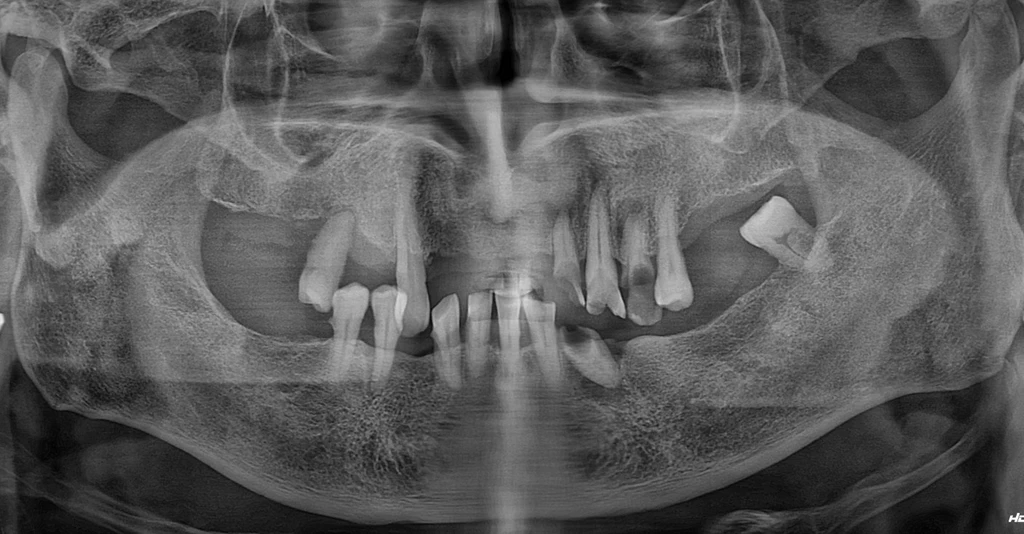 before_image