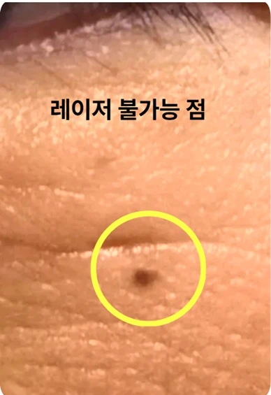 before_image