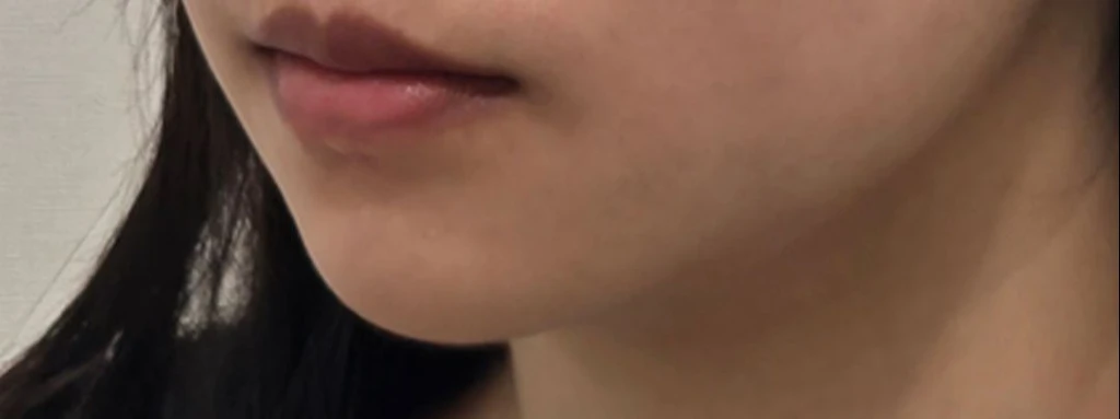 before_image