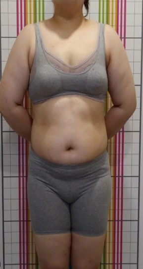 before_image