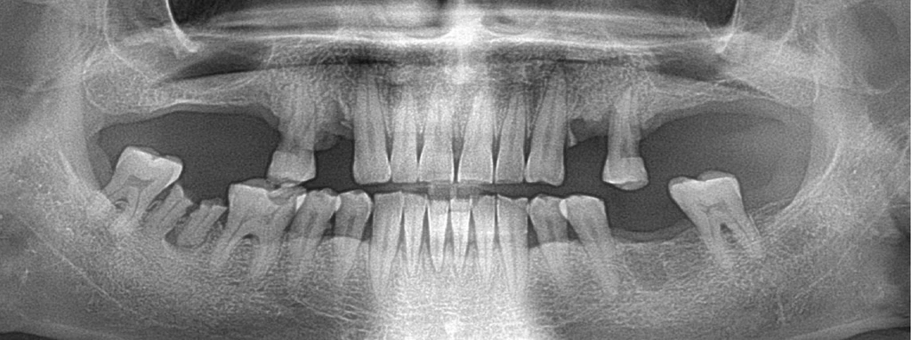 before_image