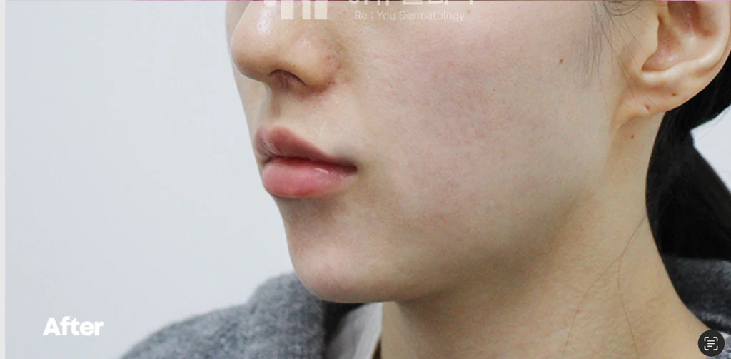 before_image