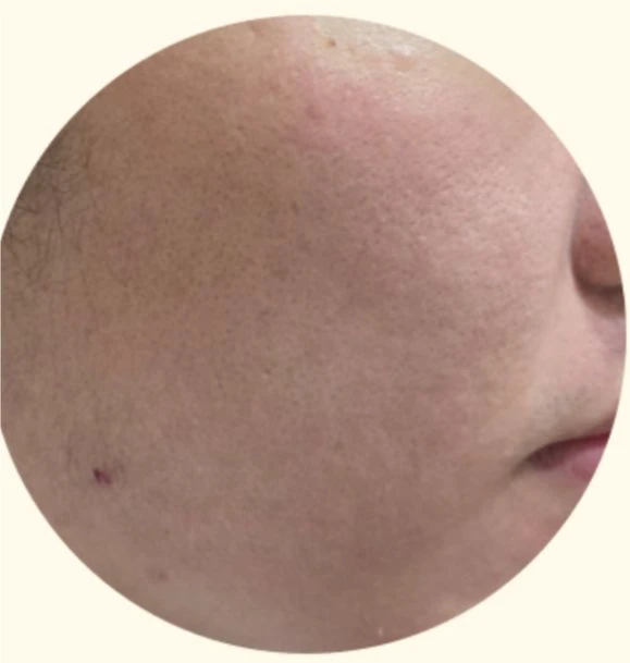 before_image