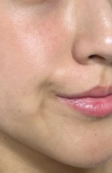 before_image