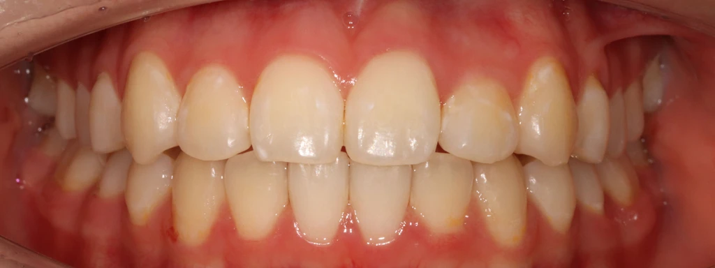 before_image