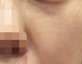 before_image
