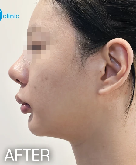 before_image