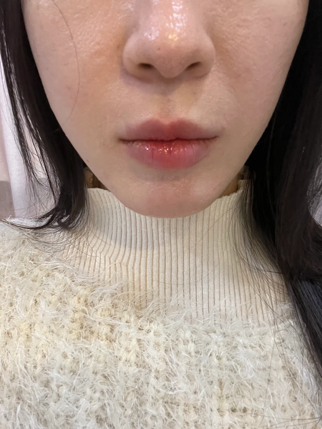 before_image