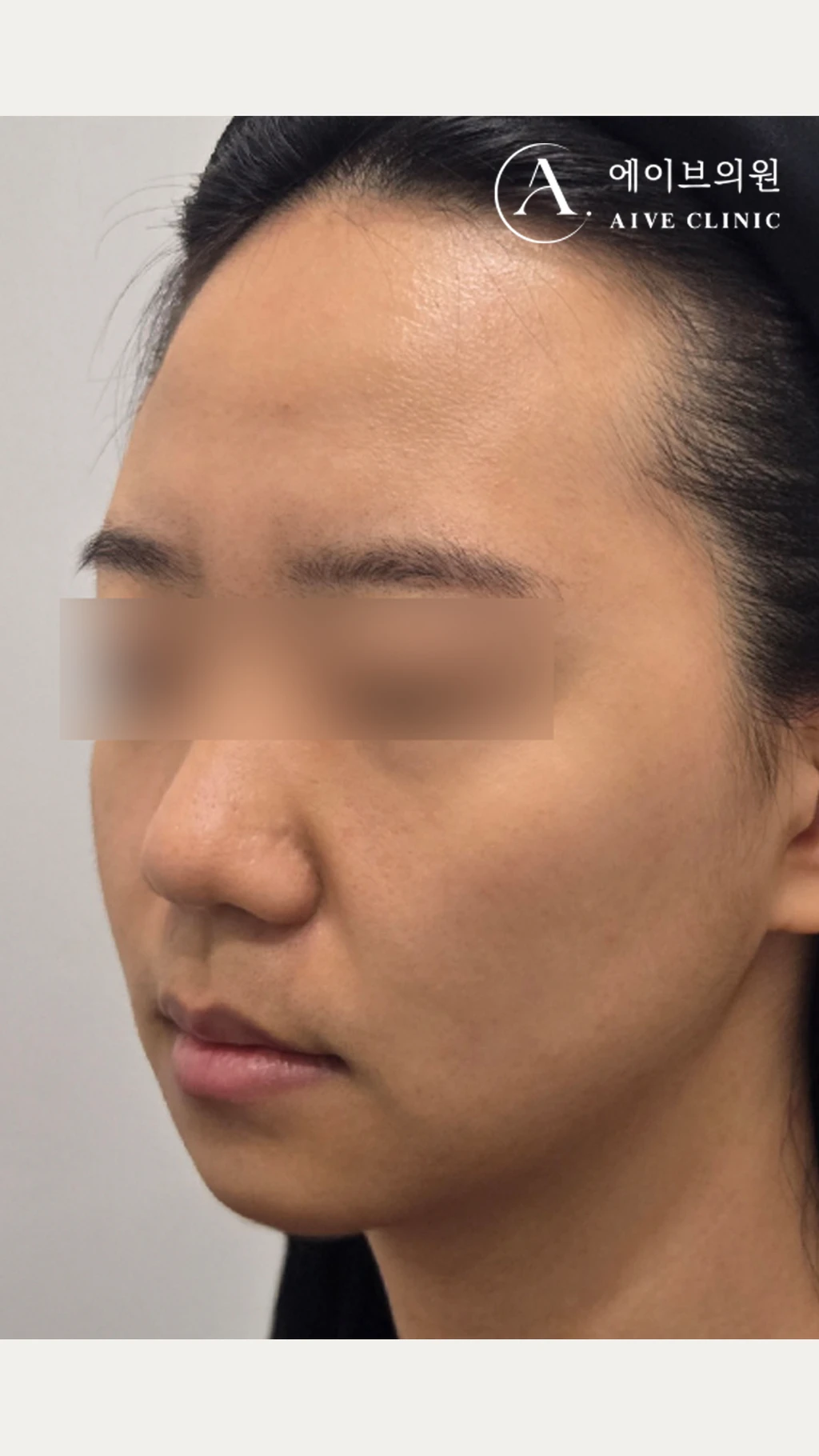 before_image