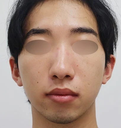 before_image