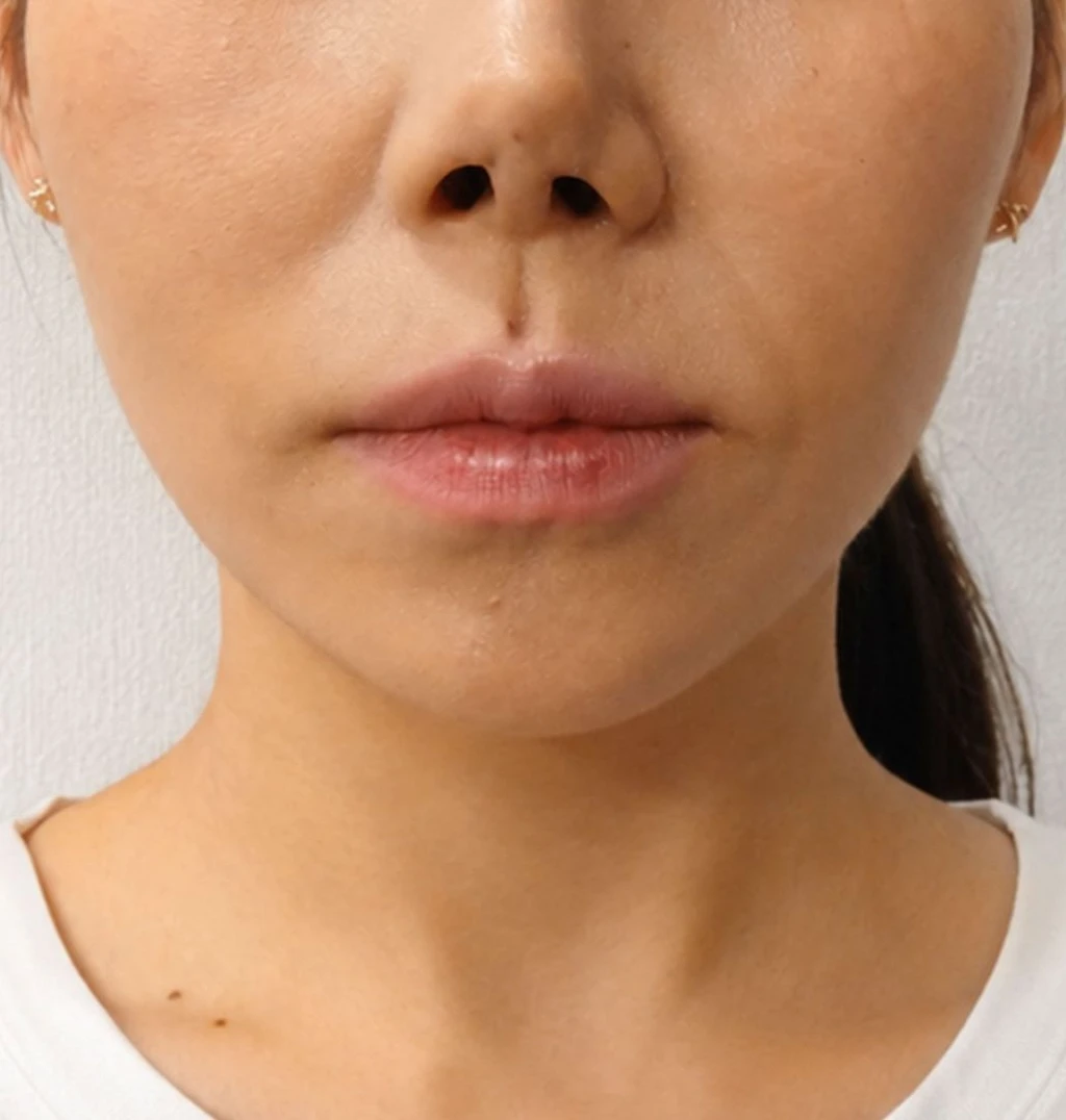 before_image