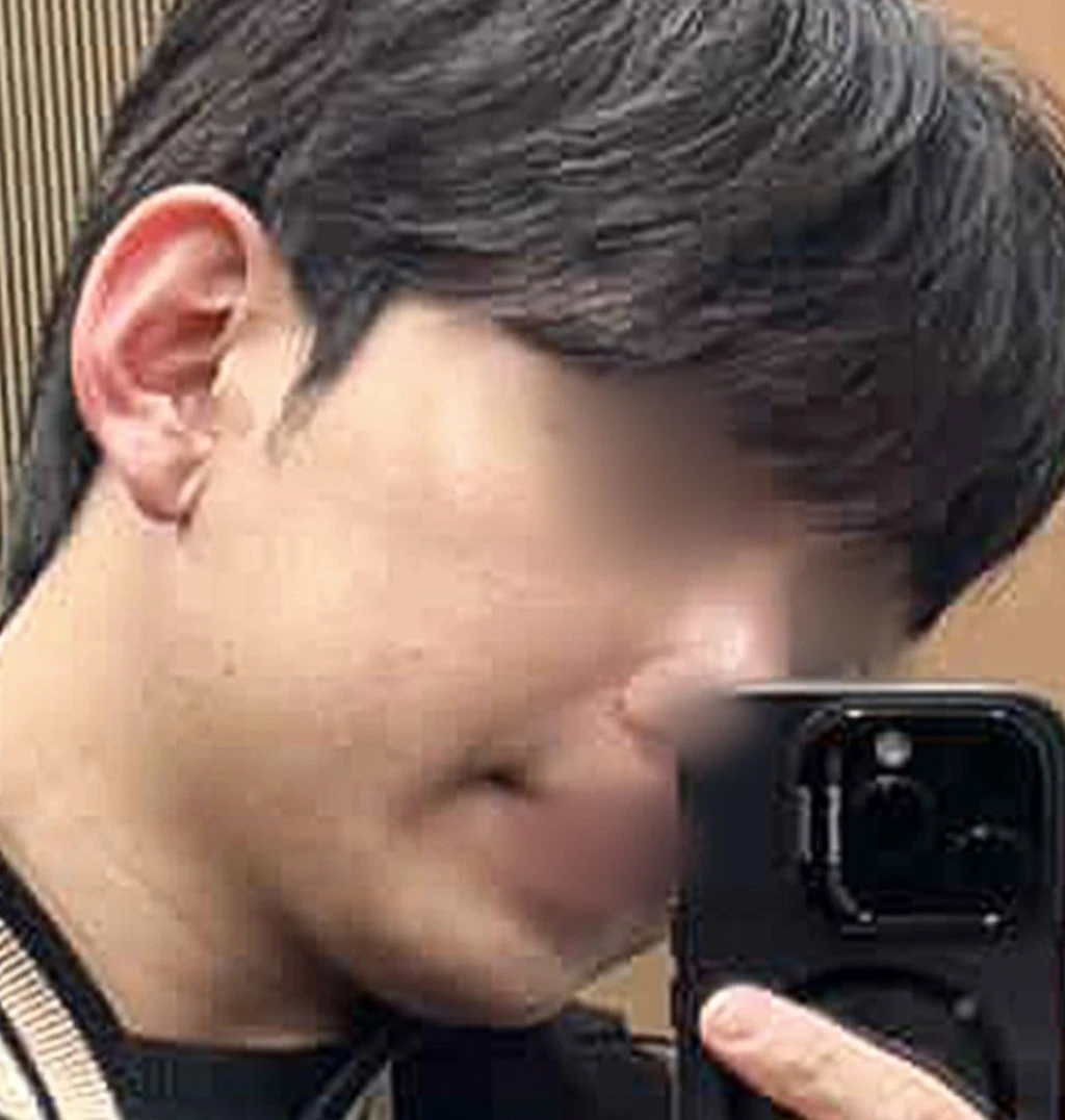 before_image
