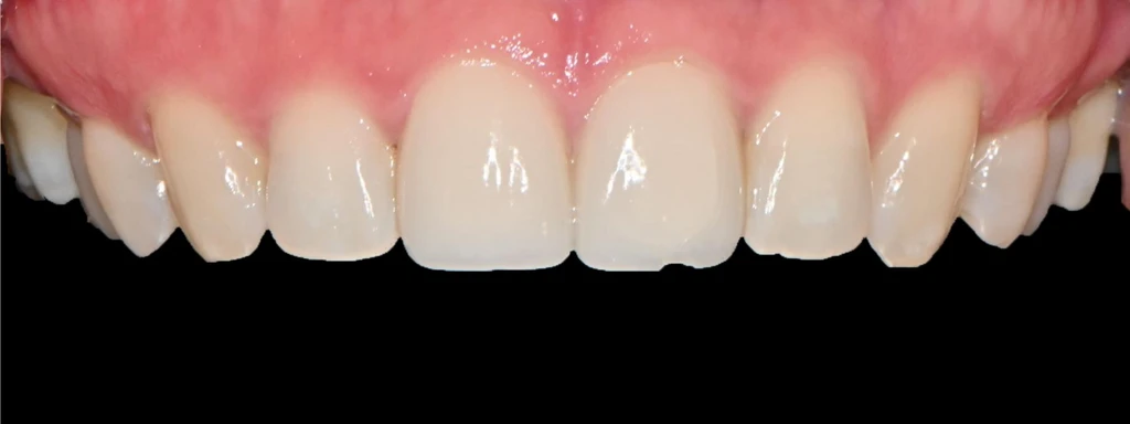 before_image