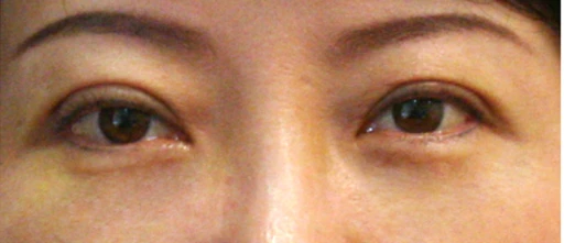 before_image