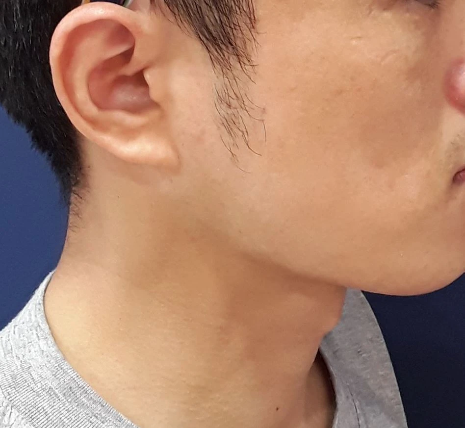 before_image