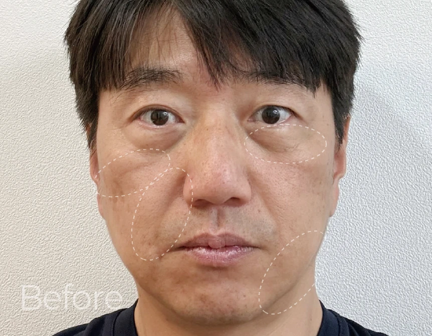 before_image