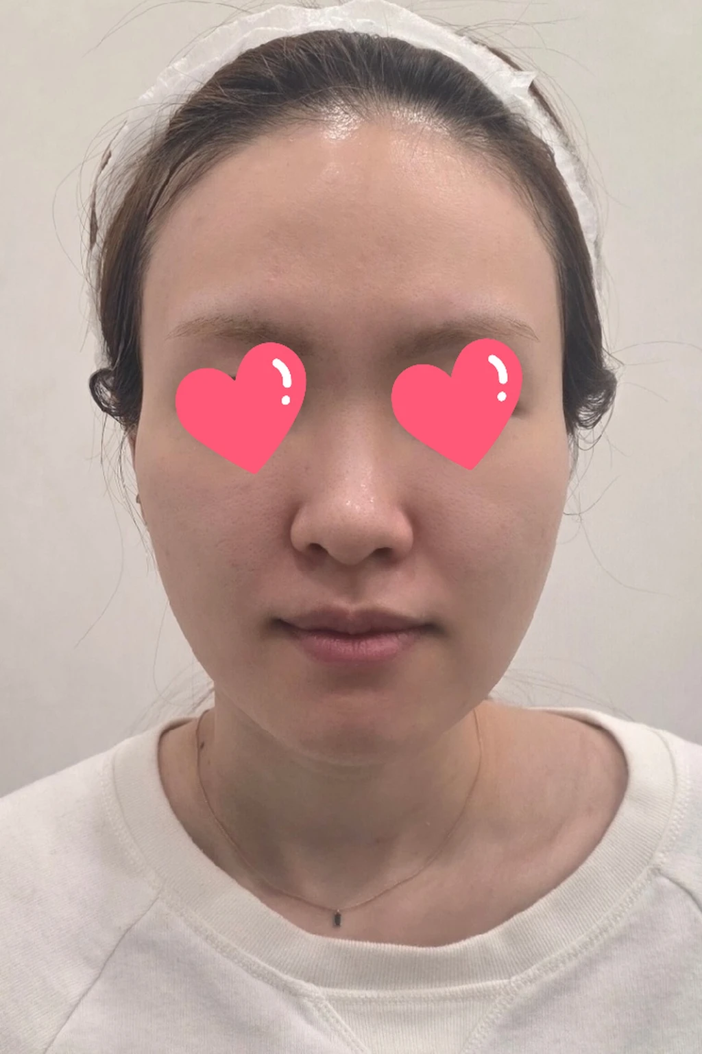 before_image