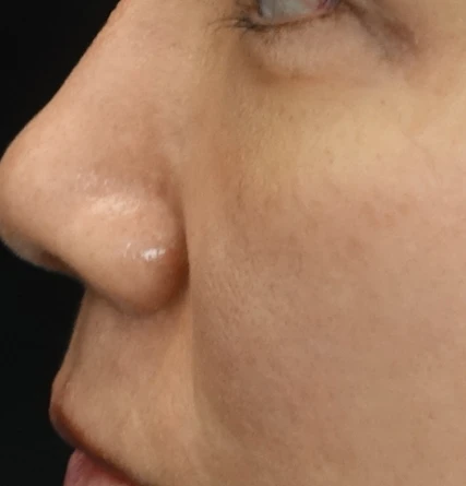 before_image