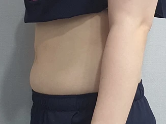 before_image