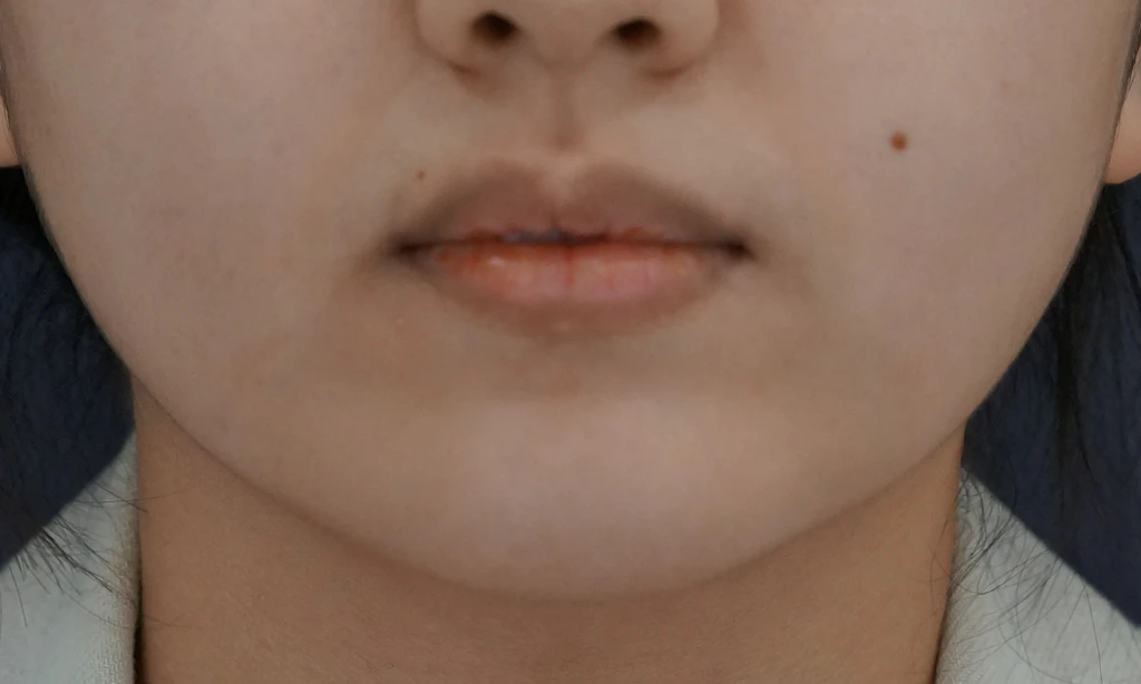 before_image