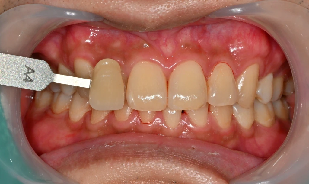 before_image