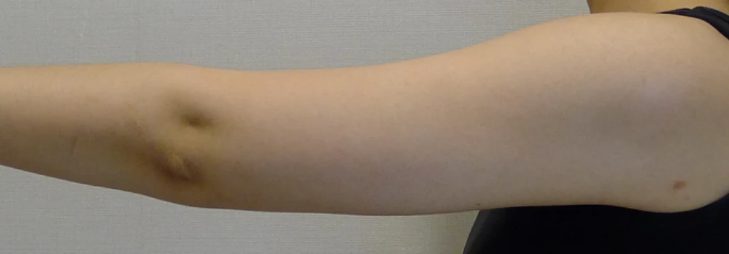 before_image