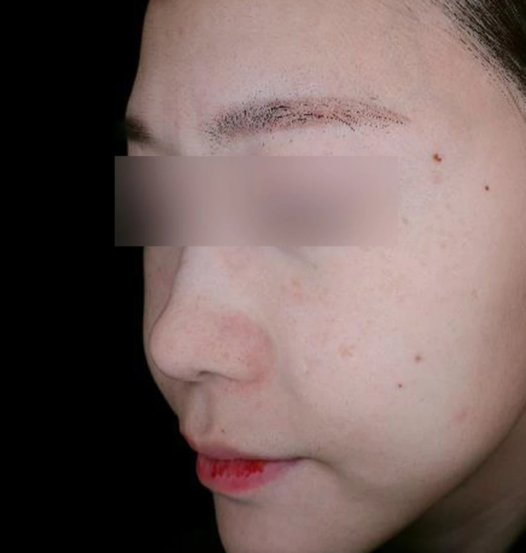 before_image